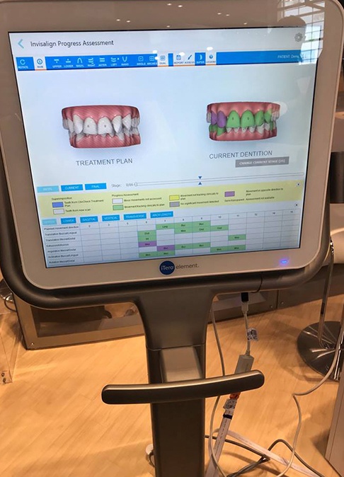 Orthodontic treatment plan on computer screen